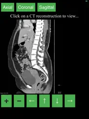 ct abdomen pelvis ipad images 3