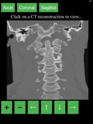 ct cervical spine ipad images 3