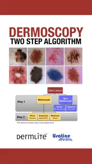 dermoscopy two step algorithm iphone images 1