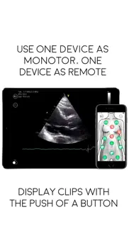 awesome ultrasound simulator iphone bildschirmfoto 1
