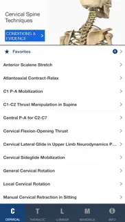 mobile omt spine iphone images 1