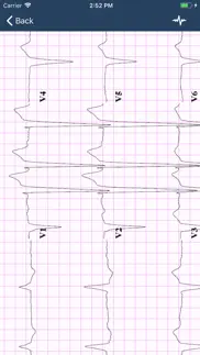 ecg guide iphone images 3