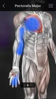 muscle trigger points iphone images 4