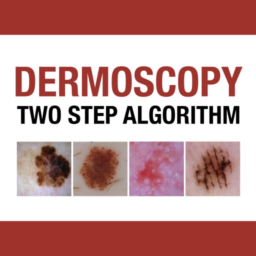 Dermoscopy Two Step Algorithm app reviews download