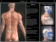 muscle trigger points ipad images 2