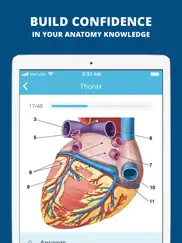 usmle clinical anatomy quiz ipad images 4