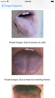 tongue diagnosis iphone images 4