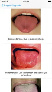 tongue diagnosis iphone images 3