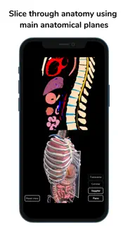 deepscope radiological anatomy iphone bildschirmfoto 2