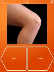 recognise knee ipad capturas de pantalla 2