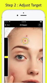 zit zapper - remove pimples iphone images 3