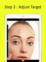 zit zapper - remove pimples ipad images 3