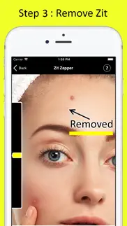 zit zapper - remove pimples iphone images 4