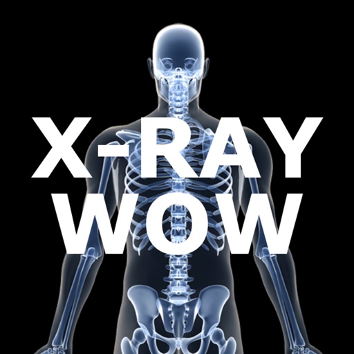 X-Ray Wow app reviews download