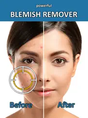 blemish remover photo tool ipad images 1