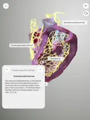 3d heart anatomy ipad capturas de pantalla 2