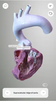 3d heart anatomy iphone capturas de pantalla 1