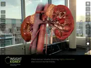 insight kidney ipad images 3