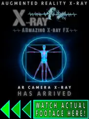 armazing x-ray fx ipad capturas de pantalla 1