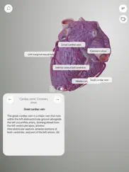 3d heart anatomy ipad capturas de pantalla 4