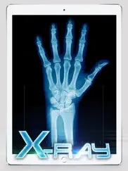 best x-ray ipad images 3