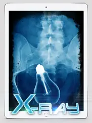 best x-ray ipad images 2