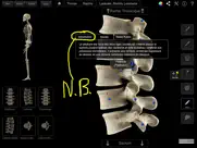 skeleton system pro iii iPad Captures Décran 2