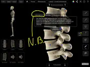 skeleton system pro iii ipad bildschirmfoto 2