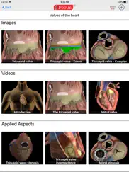 heart - digital anatomy ipad images 3