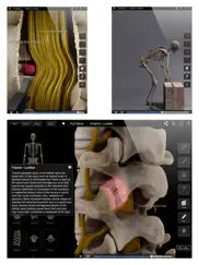 spine pro iii iPad Captures Décran 2