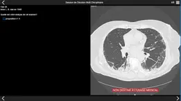 fibrose pulmonaire 2017 iphone images 2