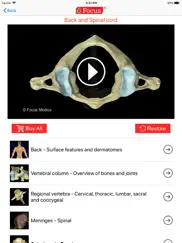 back and spinal cord ipad images 2