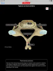 back and spinal cord ipad images 4