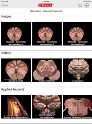 neuroanatomy - digital anatomy ipad images 3