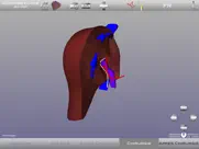chirurgie du foie ap-hp iPad Captures Décran 3