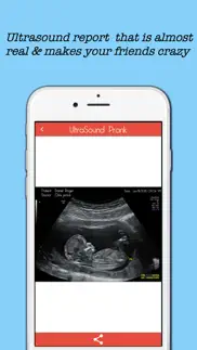 baby ultrasound spoof iphone images 2