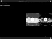 cours tdm multicoupe du thorax ipad images 2