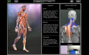 muscle trigger point anatomy iphone capturas de pantalla 1