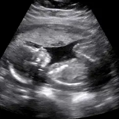 Baby Ultrasound 2015 app reviews