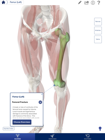 rehabilitation for lower limbs iPad Captures Décran 3