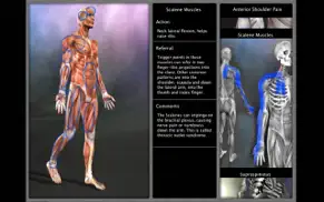 muscle trigger point anatomy iphone capturas de pantalla 2
