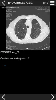 cours tdm multicoupe du thorax iphone images 1