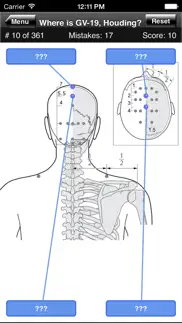 acupuncture points body quiz iphone images 4