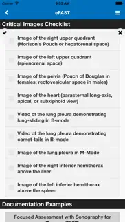 sonosupport: a clinical emergency medicine and critical care ultrasound reference tool iphone images 3