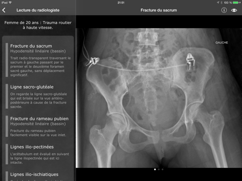 realworld orthopaedics iPad Captures Décran 2