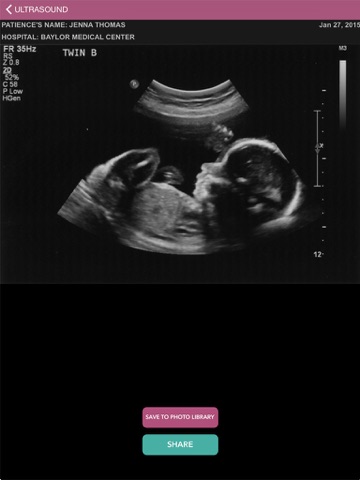 baby ultrasound 2015 ipad images 1