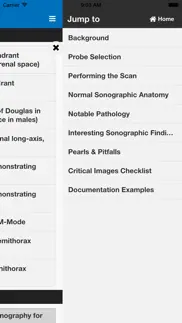 sonosupport: a clinical emergency medicine and critical care ultrasound reference tool iphone images 4