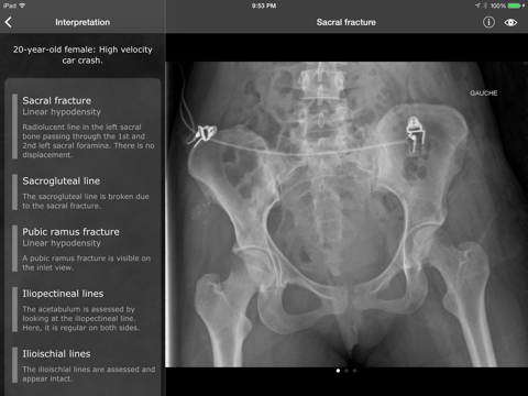 realworld orthopaedics ipad resimleri 2