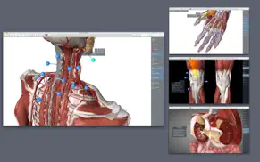 essential anatomy 5 iphone capturas de pantalla 4