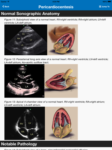 sonosupport: a clinical emergency medicine and critical care ultrasound reference tool ipad images 2